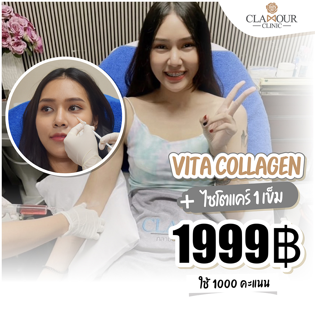 สมาชิกไลน์ ใช้คะแนน 1000 คะแนน แลกซื้อ Vita collagen 1 ครั้ง + ไซโตแคร์ 1 เข็ม 1999 บาท